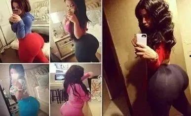 美国网红臀部爆炸事件,惊悚瞬间背后的真相揭秘