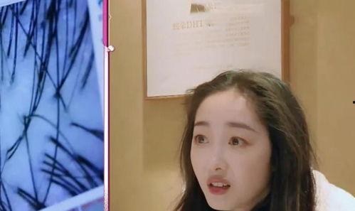 女明星治便秘,如何轻松告别便秘困扰