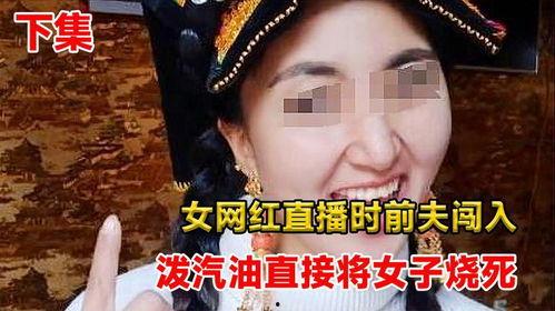 女网红被前夫烧